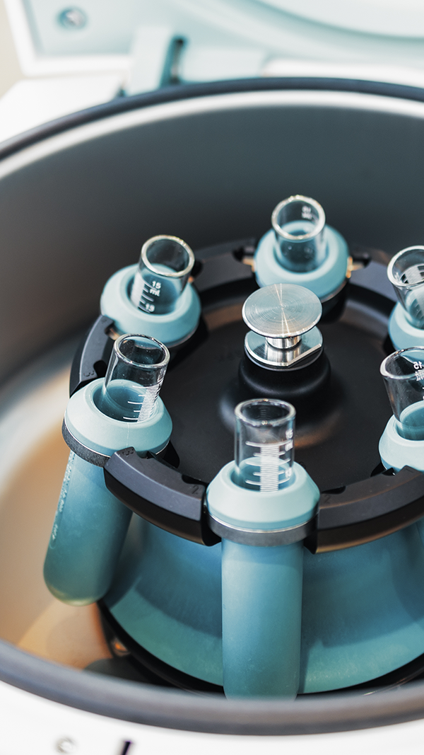 What Is Centrifuge Control